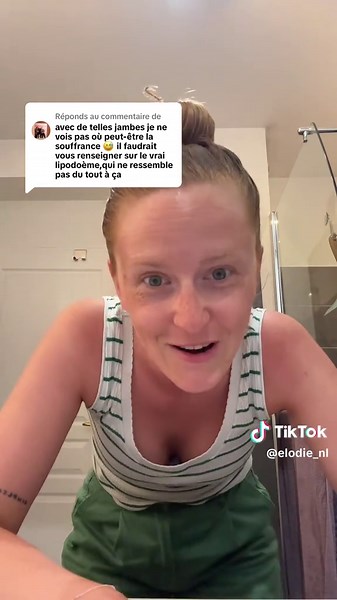 Comprendre le Lipoedème et ses Symptômes