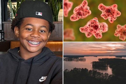 12-year-old boy killed by brain-eating amoeba after swim in South Carolina lake