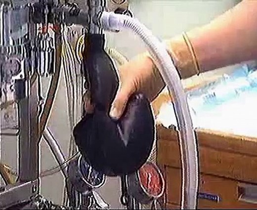 anesthesia induction