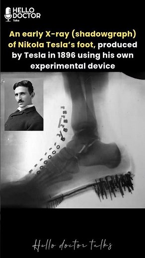 An early X-ray (shadowgraph) of Nikola Tesla’s foot, produced by Tesla in 1896 using his own device
