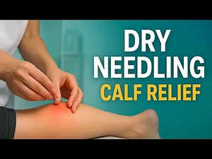 Dry Needling for Calf Muscle Pain | Instant Relief & Recovery