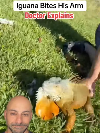 Only in Florida. 🦎 But let's talk about why this is actually serious. Iguanas carry a cocktail of bacteria in their mouths — including Salmonella, E. coli, and multiple strains that are highly resistant to basic treatment. A bite that breaks the skin isn't just a cool story. It's an open invitation for infection. If an iguana bites you, you need antibiotics. Not tomorrow. Not when it starts looking weird. Now. Reptile bites get infected fast, and what starts as a minor puncture wound can progre