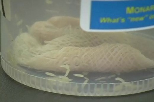 Maggot therapy (warning, graphic images)