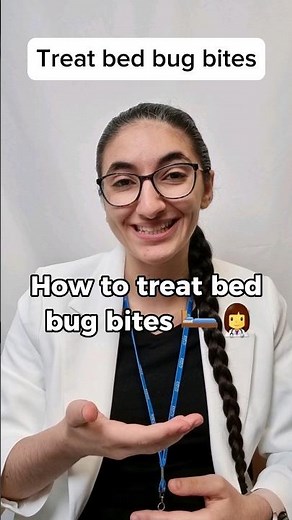 How to treat bed bug bites