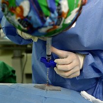 Video: Isolation and Cellular Phenotyping of Mesenchymal Stem Cells Derived from Synovial Fluid and Bone Marrow of Minipigs