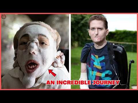 13 of the Strangest Appearances on the Planet That Break Medical Barriers and Conquer Life.