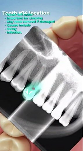 🦷 What is tooth #14?
