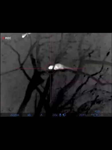 Understanding Ultrasound Imaging of Fetal Development