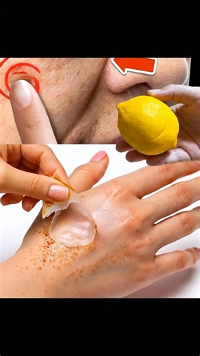 SKIP this if you DON'T WANT to Remove Age Spots Naturally. FULL RECIPE BELOW 👇👇 | Health Tips Tricks