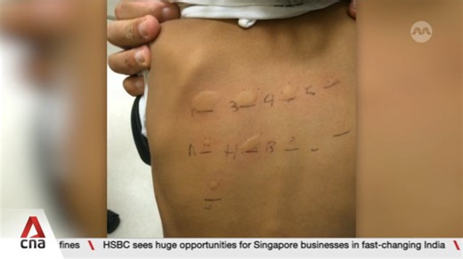 New national study on childhood food allergies in Singapore