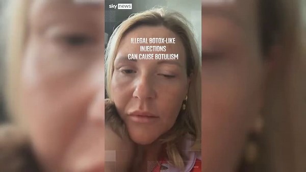 ‘Doctors thought I had a stroke after botox-like injection’