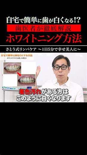 ☝本編はコチラ！【自宅で簡単】驚くほど歯が白くなるホワイトニング方法を歯医者が徹底解説します！#shorts #ホワイトニング #セルフ #歯