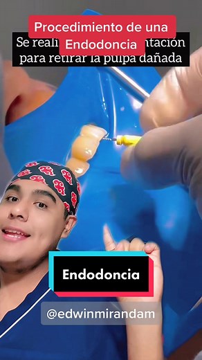 Procedimiento de una Endodoncia