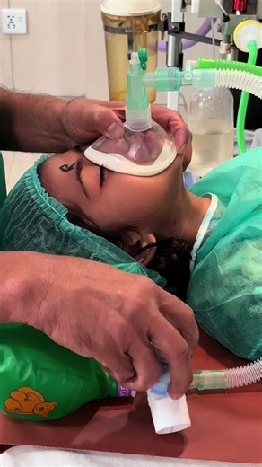 Intubation of general anaesthesia with eundo tricyal tube dear TikTok please unfreeze my account #generalanesthesia #surgery #anesthesiologist #unfreezemyaccount #anesthesia