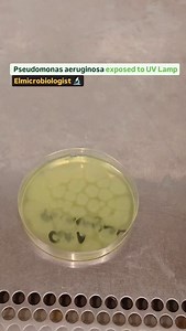 Pseudomonas aeruginosa exposed to UV lamp. Ps. aeruginosa is well known by its pigment production especially pyoverdine and Pyocyanin. Theses pigment give Pseudomonas aeruginosa a characteristic colony morphology color which is can be easily detected in a media that supports pigments release such as King Media, and Cetrimide agar. #Elmicrobiologist 🔬 | Elmicrobiologist