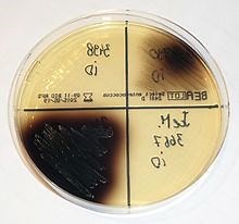 Bile esculin agar - Alchetron, The Free Social Encyclopedia