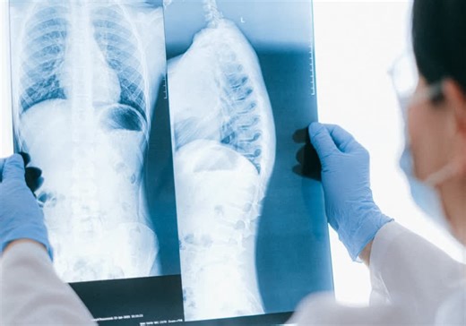 AI is just as good as a doctor at analyzing chest X-rays