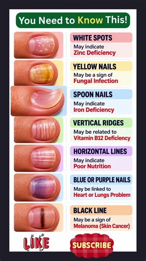 7 Nail Signs That May Reveal Health Problems! 😱 | Nail Health Facts #Shorts