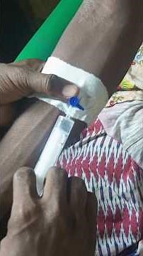 Basic IV Cannulation Technique