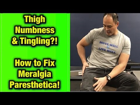 Thigh Numbness/Tingling? It’s Meralgia Paresthetica! Do This! | Dr Wil & Dr K
