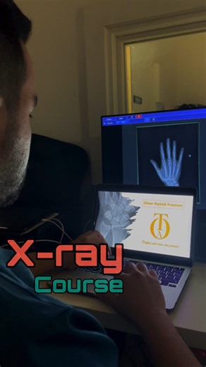 Abdallah Odat on Instagram‎: "كورس الX-ray الاقوى على الاطلاق 👊🏻 كان معي بهذا الكورس اكثر من 50 طالب خلال الشهرين الماضيات واليوم جاي اعلن عن افتتاح التسجيل للدفعة الثالثة المعلومات الي رح تاخذها بهذا الكورس رح تخليك قادر تستلم جهاز الX-ray لحالك بكل ثقه يوجد قسم نظري وقسم عملي "اختياري" للناس الموجودين داخل الاردن مع زميلي @rt_rayyan للتفاصيل ابعثولي او ابعثو لريان مسج ورح نرد عليكم باسرع وقت 🔥"‎