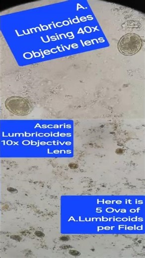 Ascaris Lumbricoides with 40x and 10x Objective lens