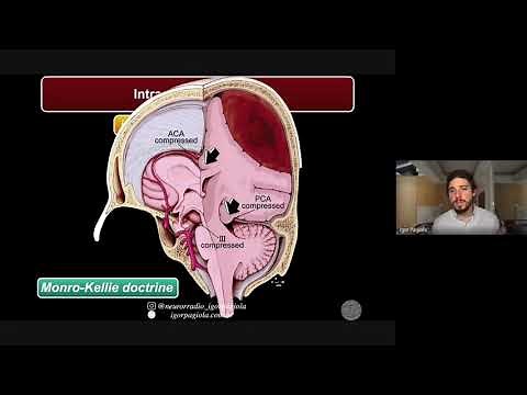 PRESSÃO INTRACRANIANA