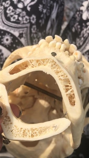 Did you know that’s what the inside of your jaw looks like? Tag a friend who needs to see it!