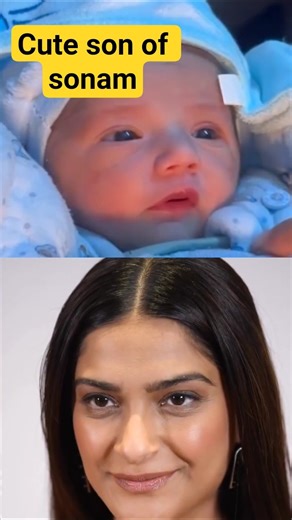 Sonam Kapoor Baby Face Reveal Viral 😱 Fans Hue Emotional