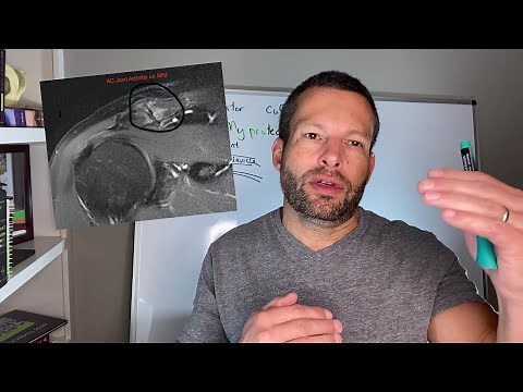 What is the distal clavicle and what do we do with it when it is injured?!