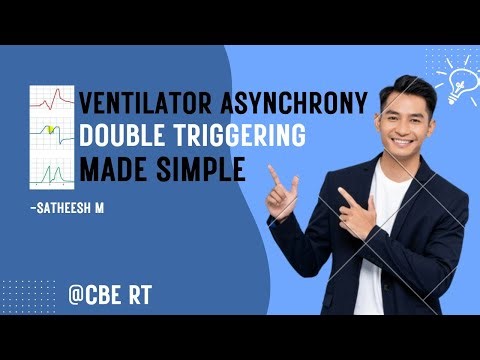 Ventilator Asynchrony: Double Triggering Made Simple