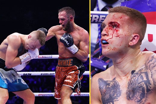 Campbell Hatton loses again as Ricky Hatton’s son suffers horror cut and fails to get redemption over boxer who took his unbeaten record