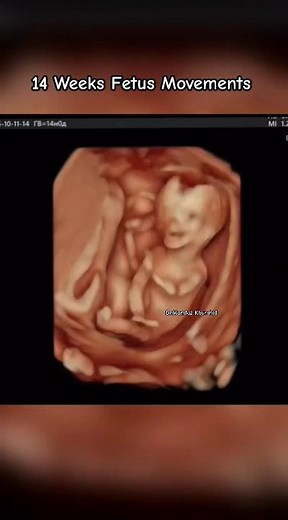 Unbelievable Baby Movements During Ultrasound