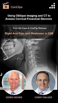Using Oblique Imaging and CT to Assess Cervical Foraminal Stenosis