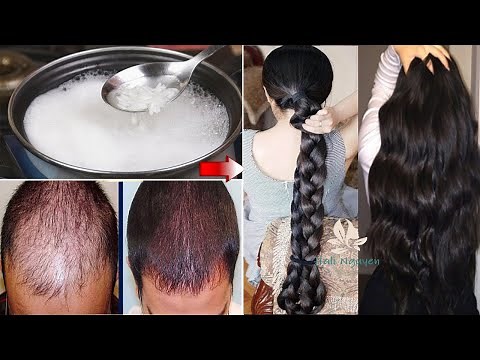 3 Cách LÀM TÓC DÀI NHANH Mọc CẤP TỐC Trong 1 Đêm 100% Hiệu Quả - Cách Trị Hói Đầu Cách Trị Rụng Tóc