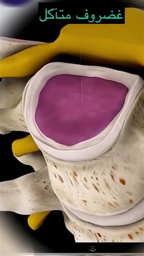 Stages of back cartilage formation