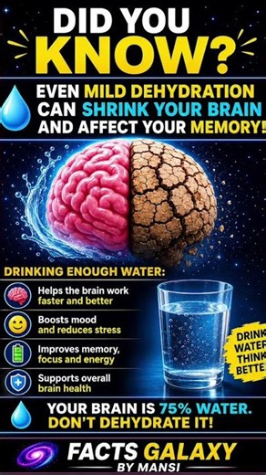💧 Your brain is 75% water 😳 Stay hydrated!