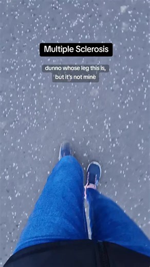 someone come collect your leg please it's defective #ms #multiplesclerosis #msawareness #rrms