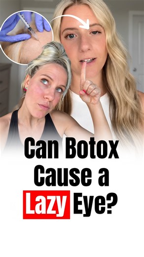 HOW TO TIGHTEN SAGGY EYELIDS NATURALLY AT HOME