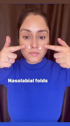 Nasolabial folds #nasolabialfolds #smilelines | Face._sculpting