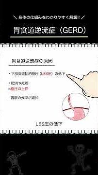 Gastroesophageal reflux disease / Anatomy and Physiology