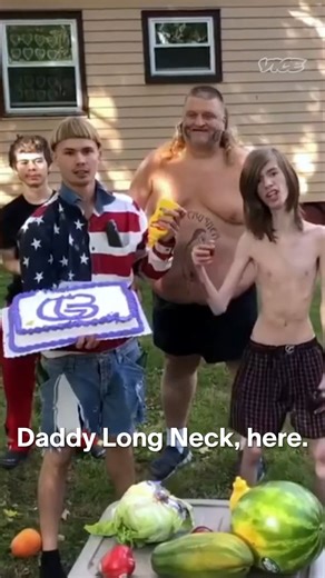 1.7M views · 9.1K reactions | David has spent his life in and out of hospitals where he received multiple rounds medical tests in an attempt to diagnose why he could not gain weight. Rather than be discouraged by his physical appearance, David has embraced it as his signature style to make him one of the most recognizable people on the Internet. | VICE | Facebook