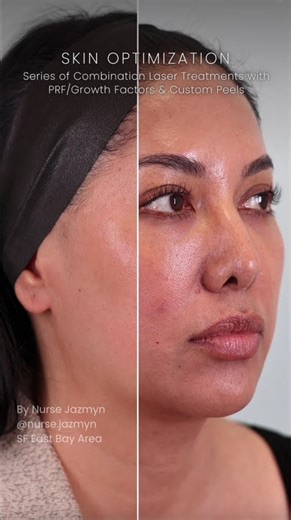 Bay Area Skin Optimization