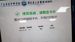 广东省人民医院CT检查影像资料拷贝办理案例 日月天心