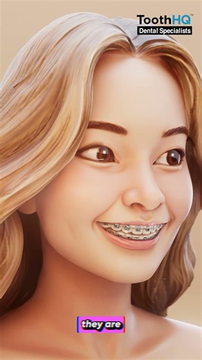 How do metal braces help with bite problems?