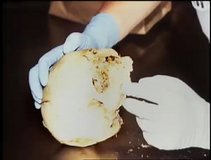 Forensic Files Season 6 Episode 16 Part 1 Skin of Her Teeth | Crime Story Files