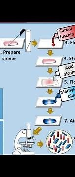 Acid fast staining or ziehl Nielsen carbol fuchsin stain part 3