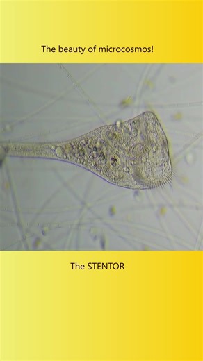 The beauty of an microorganism! #stentor #microscopy #biology #nature #science #shorts