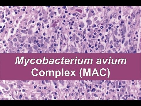Mycobacterium avium complex (MAC)