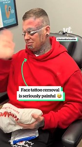 528K views · 633 reactions | Face tattoo removal is seriously painful  | VT | Facebook